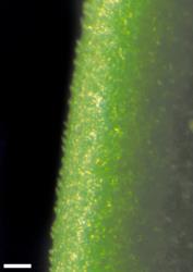 Veronica rakaiensis. Leaf margin showing minute hairs. Scale = 0.1 mm.
 Image: W.M. Malcolm © Te Papa CC-BY-NC 3.0 NZ